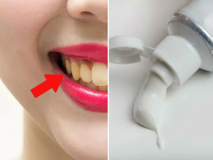 como hacer una pasta para blanquear los dientes - Cómo blanquear los dientes amarillos