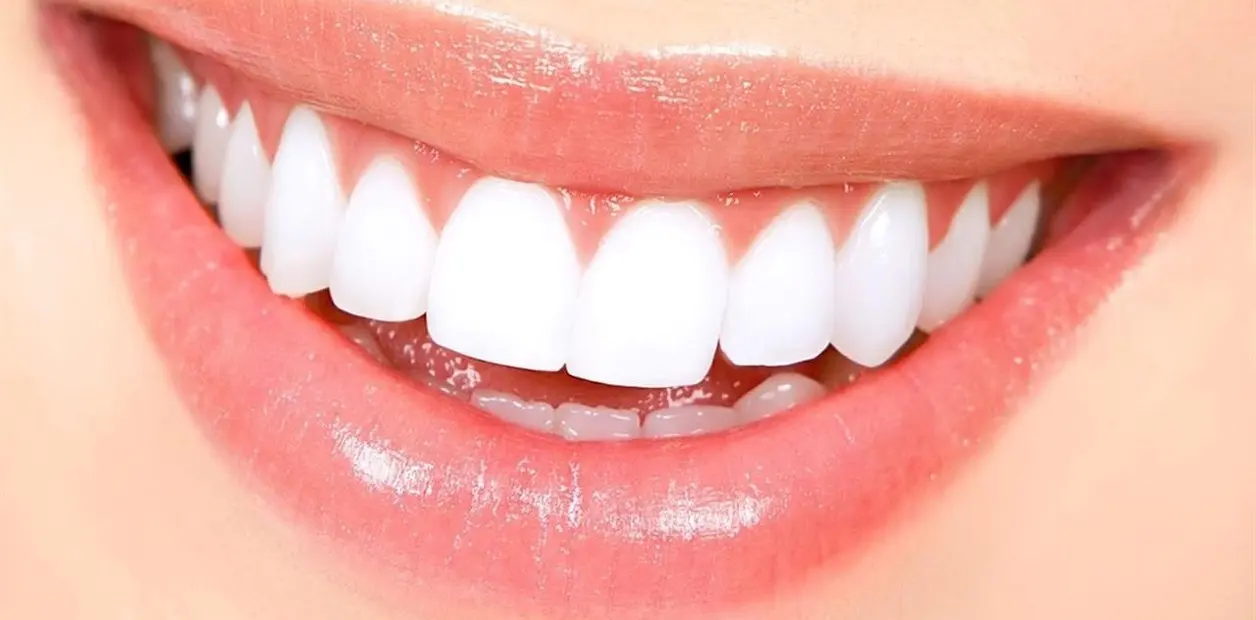 como blanquear los dientes - Cómo blanquear los dientes amarillos en 2 minutos