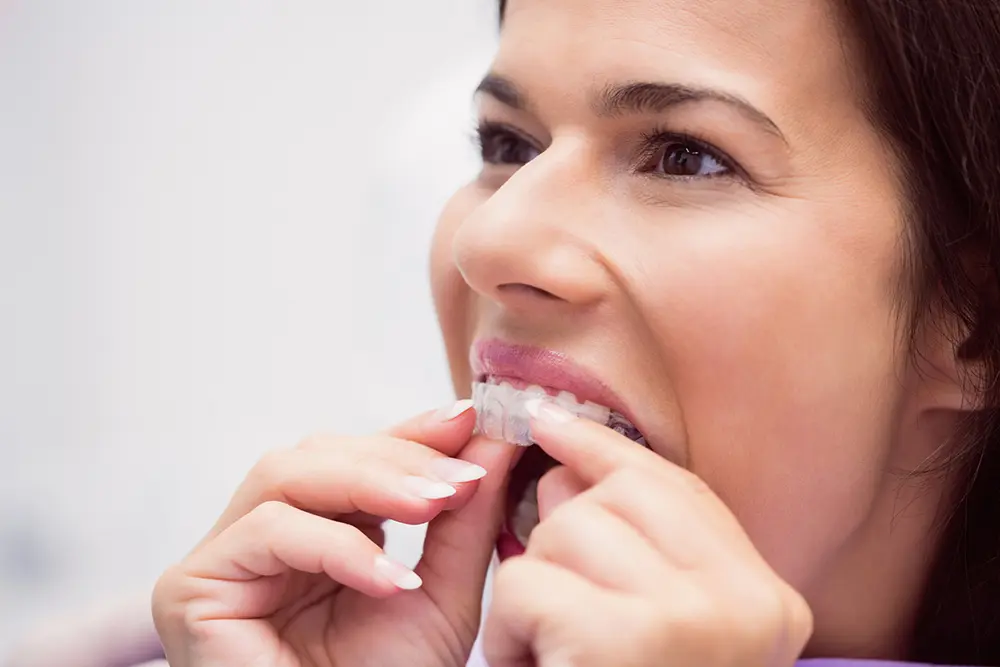 entablillado de dientes - Cómo entablillar un diente