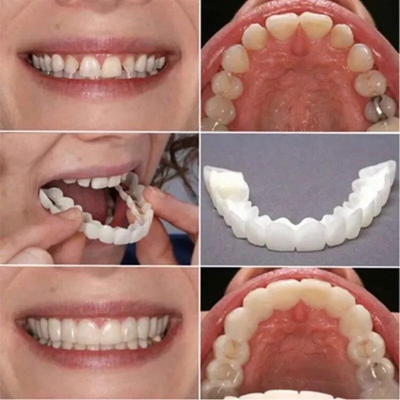 dientes falsos - Cómo se le llama a los dientes falsos