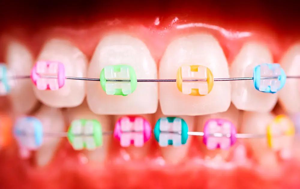 gomas dientes - Cómo se llama la goma para los dientes