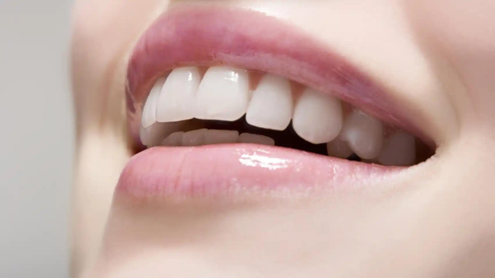 como tener los dientes blancos en 2 minutos - Cómo tener los dientes blancos al instante