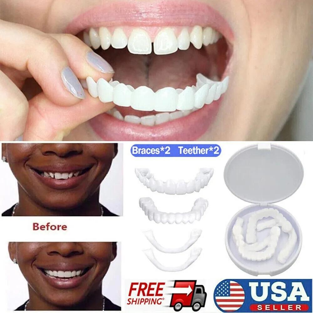 dientes blancos postizos - Cuál es el color más blanco de dientes
