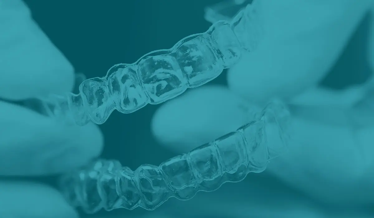 retenedores de dientes - Cuál es la función de los retenedores