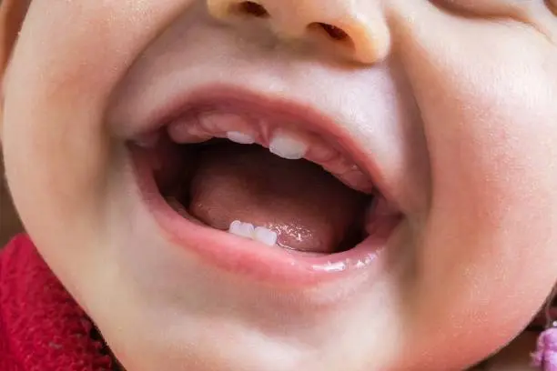 le puede dar fiebre a un bebe por los dientes - Cuándo es peligrosa la fiebre en un bebé