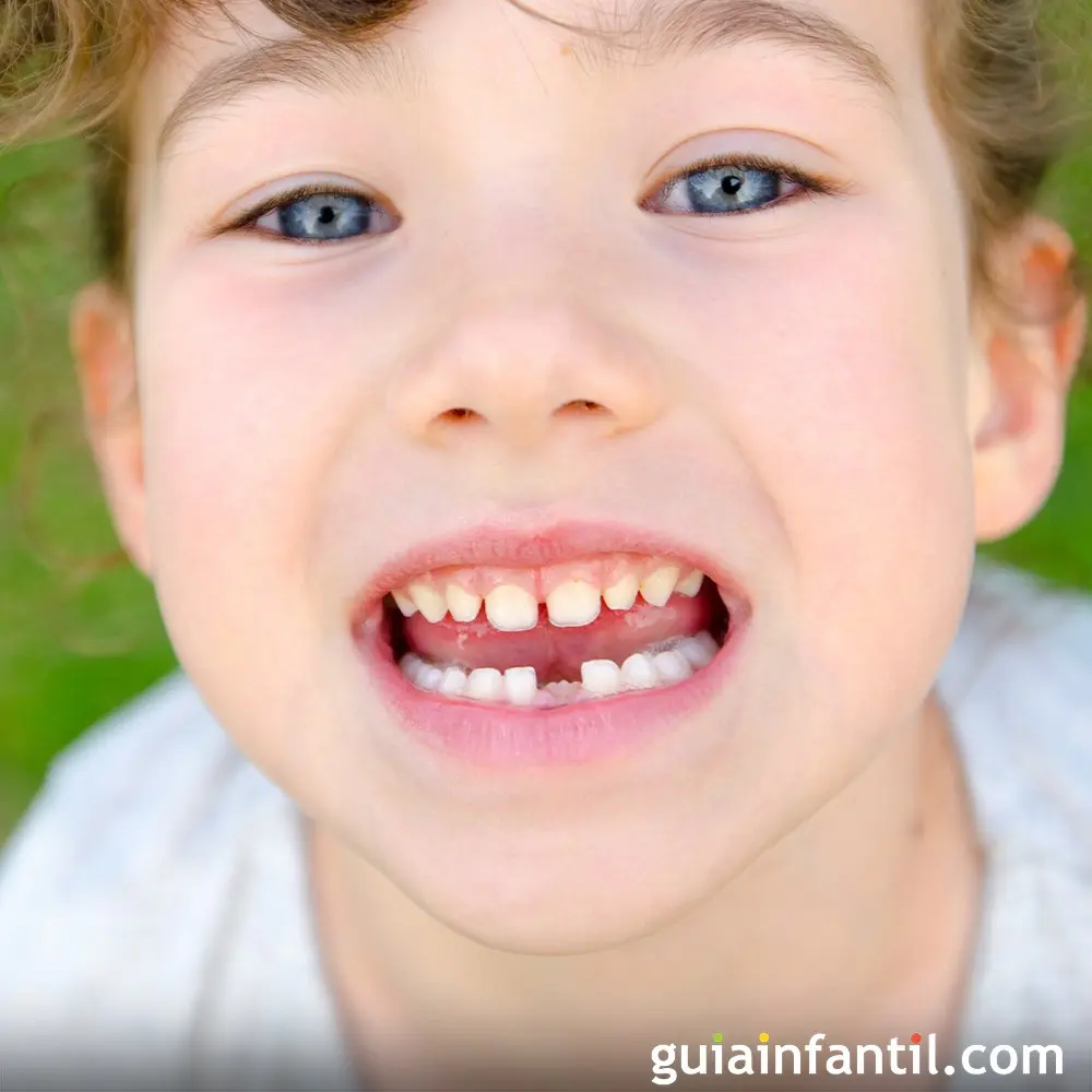 caida de dientes en niños sintomas - Cuándo se van a caer los dientes de leche duele