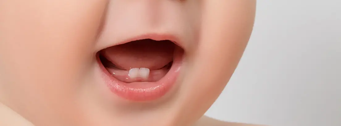 dientes temporales - Cuándo termina de salir la dentición temporal