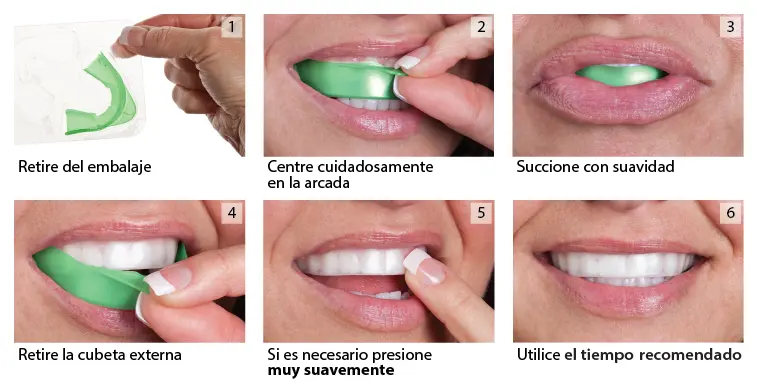 blanqueador de dientes opalescence - Cuántas veces usar opalescence
