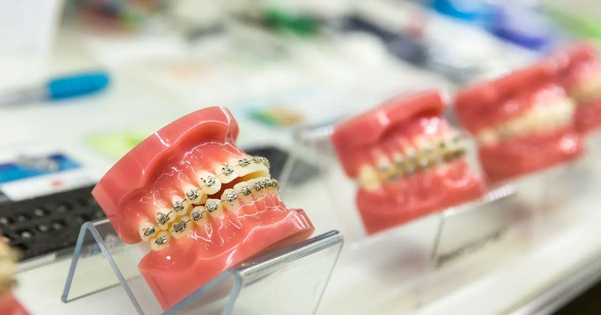 dentista ortodoncia - Cuánto cuesta hacerte una ortodoncia