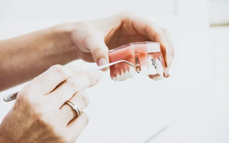 dentistas baratos cerca de mi - Cuánto puede costar un implante dental