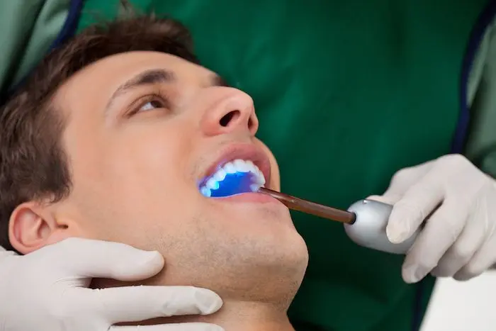 cuanto cuesta sacarse un diente en argentina - Cuánto sale una consulta al dentista en Argentina