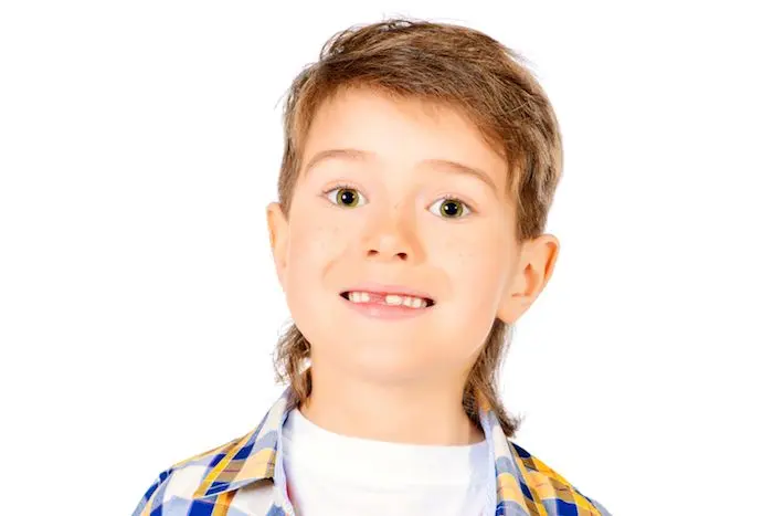 se pueden caer los dientes a los 4 años - Cuánto tarda en salir un diente a un niño de 4 años