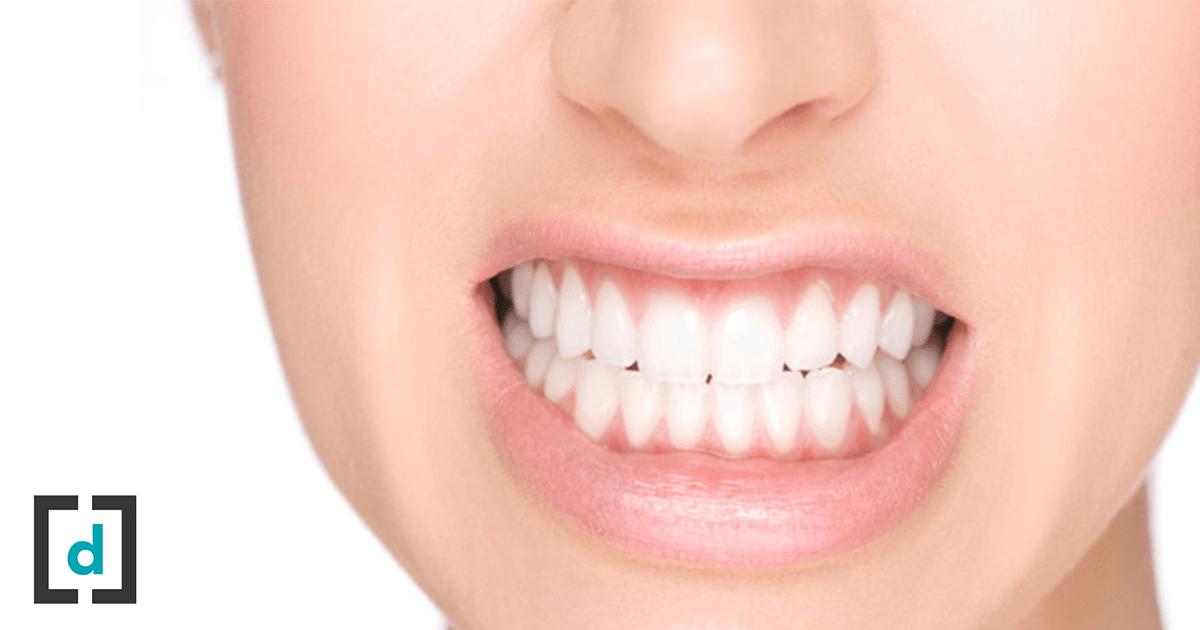 dentista especialista en bruxismo - Cuánto tiempo puede durar el bruxismo