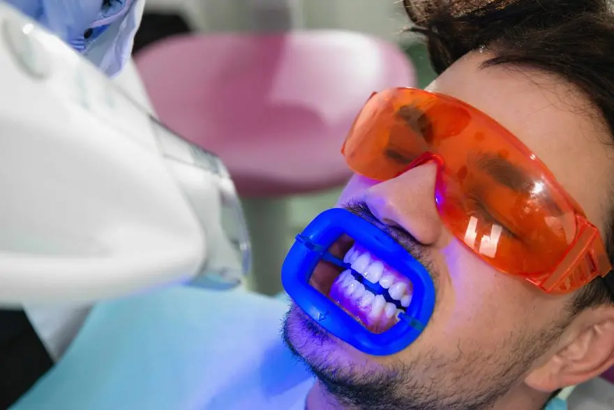 gel para blanquear los dientes - Cuánto tiempo se deja el gel para blanquear los dientes