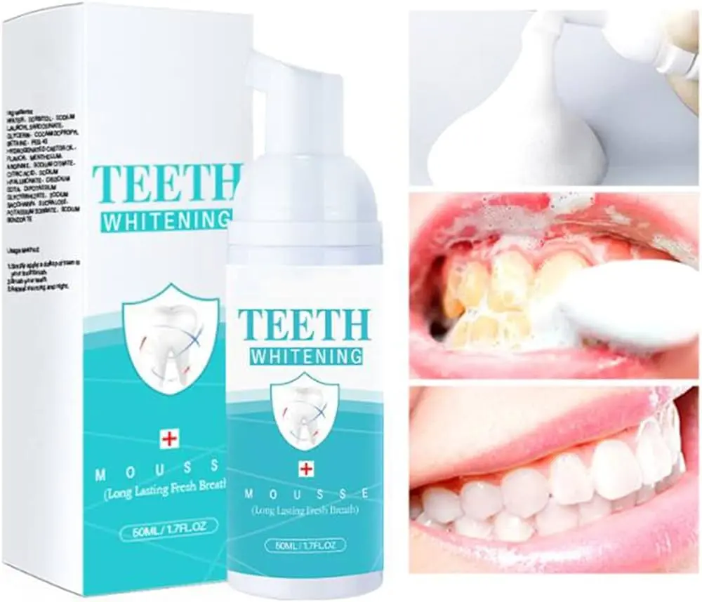 pasta dental para blanquear los dientes - Cuánto tiempo tarda en blanquear los dientes con pasta dental