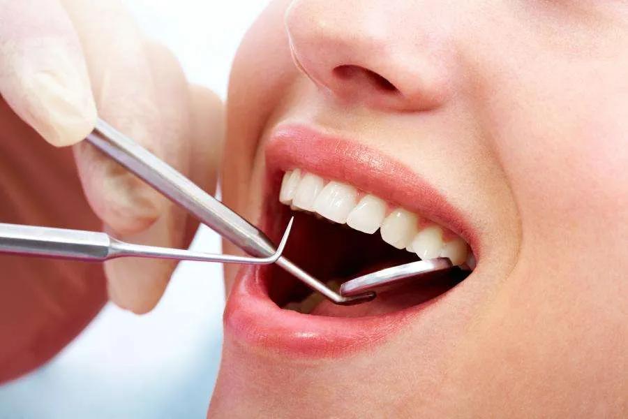 dieta blanca para blanqueamiento de dientes - Cuántos días de dieta blanca después de un blanqueamiento dental