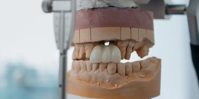 falta de dientes - Qué consecuencias le trae a una persona el hecho de no tener dientes