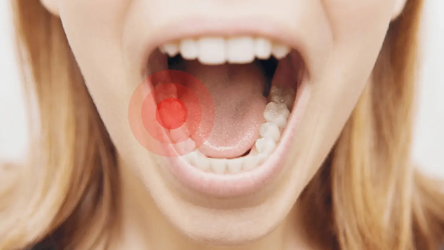 como quitar el dolor de dientes delanteros - Qué es bueno para el dolor de los dientes de adelante