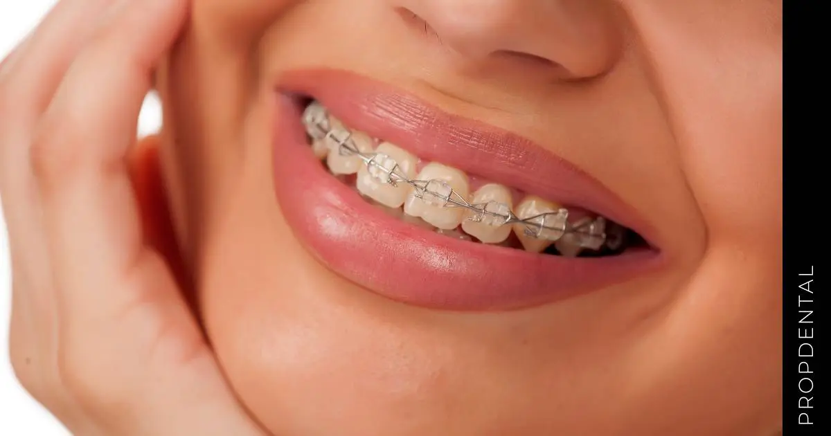 dientes cruzados - Qué es el entrecruzamiento de dientes