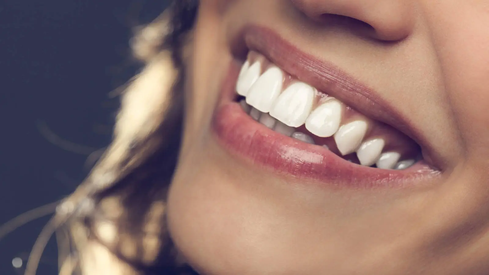 férula en los dientes - Qué es la ferulización en los dientes