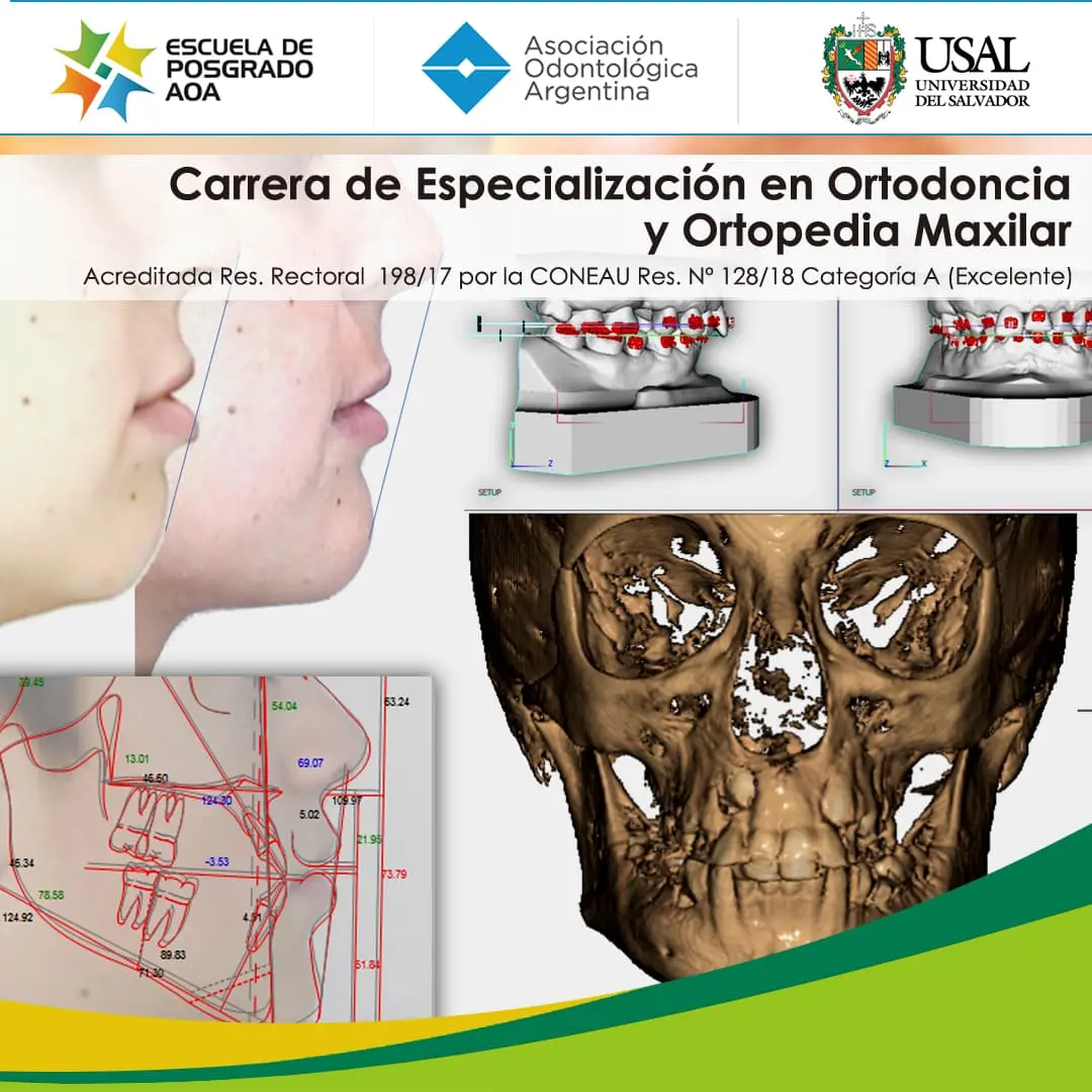 estudiar ortodoncia en argentina - Qué es ortodoncia maxilar