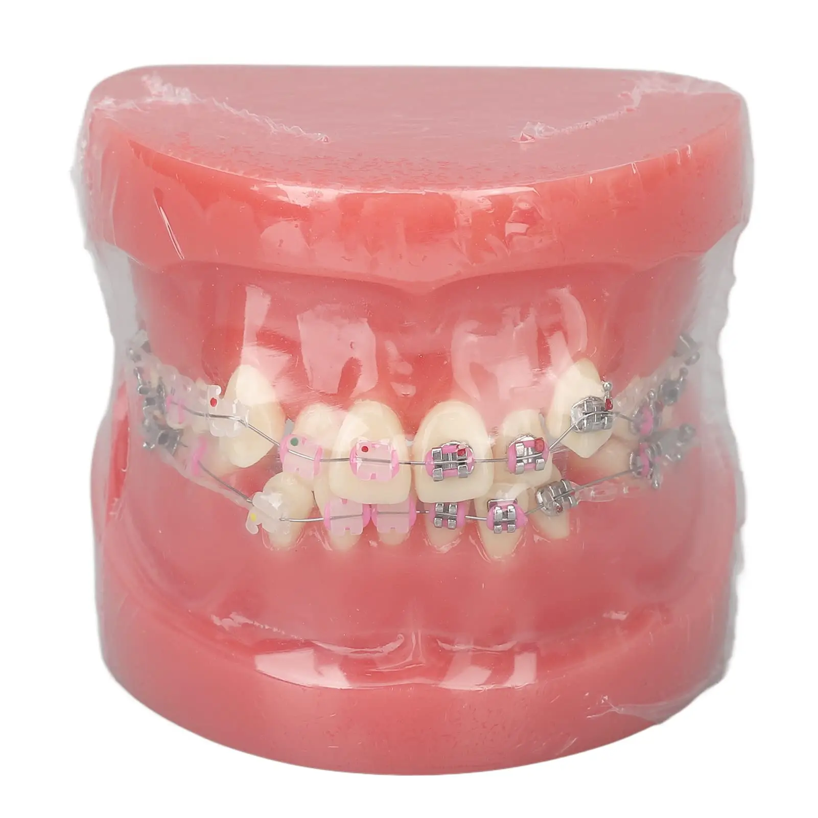 dientes postizos para niños - Qué es una prótesis dental para niños