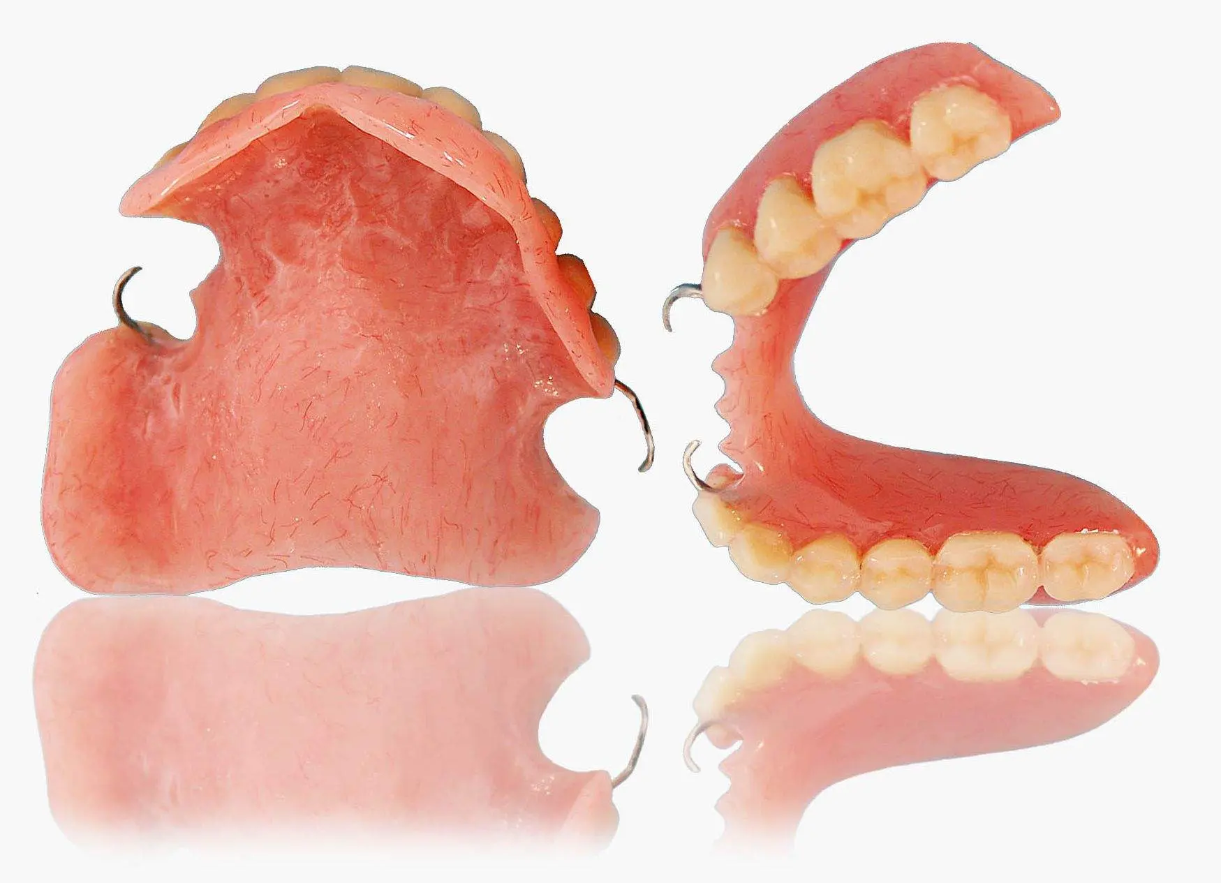 diente provisional removible - Qué es una prótesis provisional removible