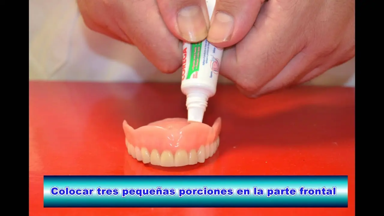 corea para los dientes - Qué función cumple el Corega en los dientes