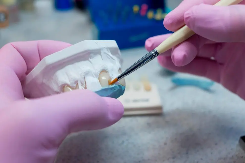 dentista san miguel - Qué hace un especialista en prostodoncia