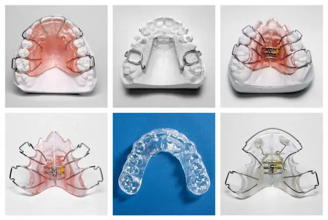 protesis y ortodoncia - Qué hace una prótesis dental