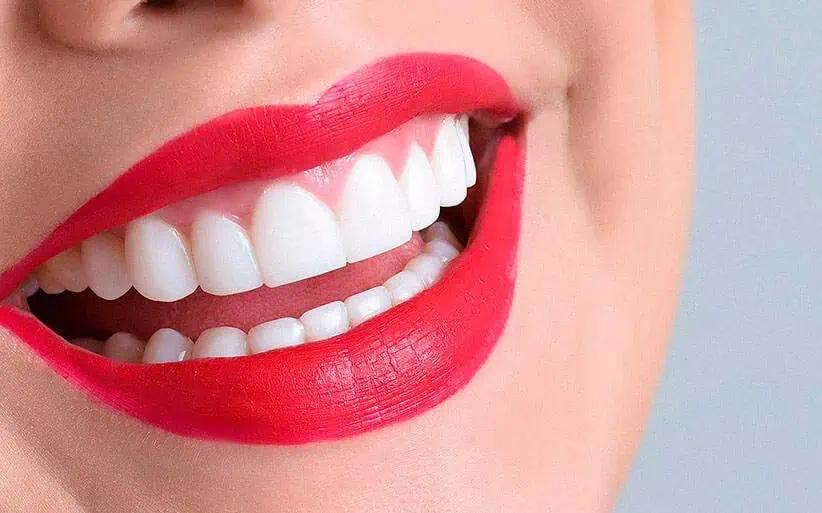dientes blancos y perfectos - Qué hay que hacer para tener los dientes blancos