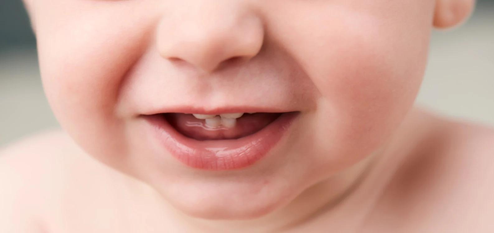 dientes en bebes de 1 año - Qué pasa si mi bebé tiene 1 año y no tiene dientes