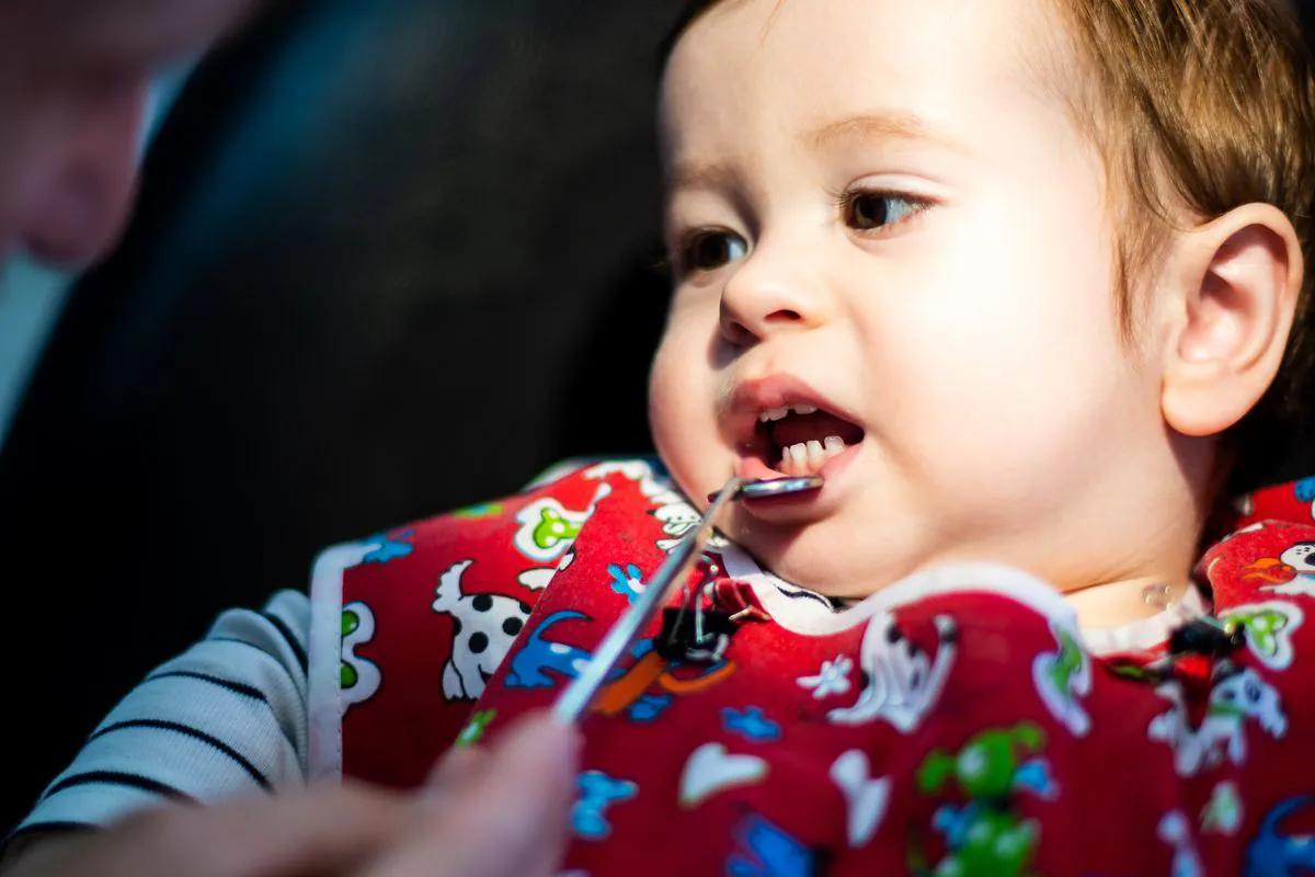 dientes picados en bebes de 1 año - Qué pasa si mi bebé tiene una carie