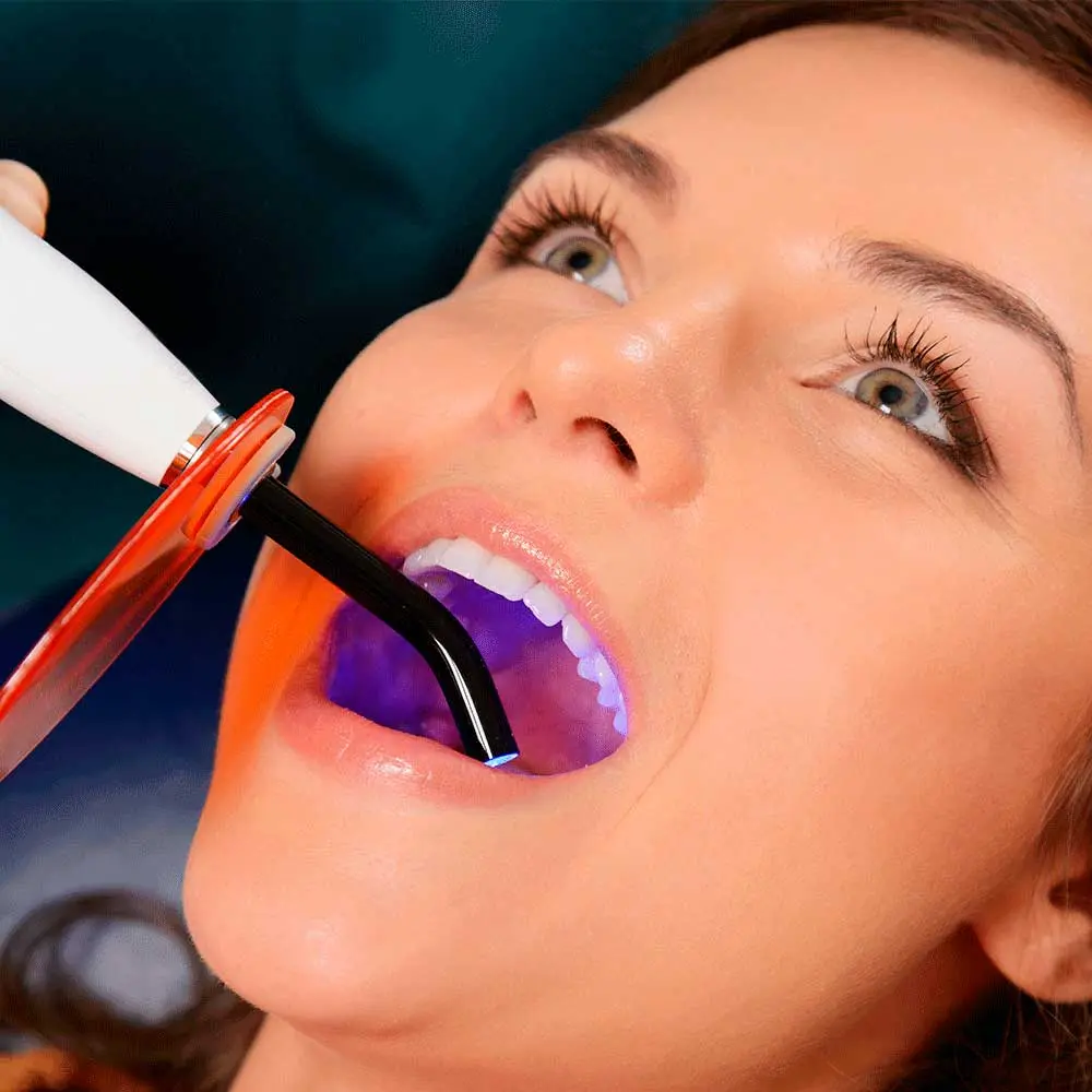 diente filtrado - Qué pasa si un empaste se filtra