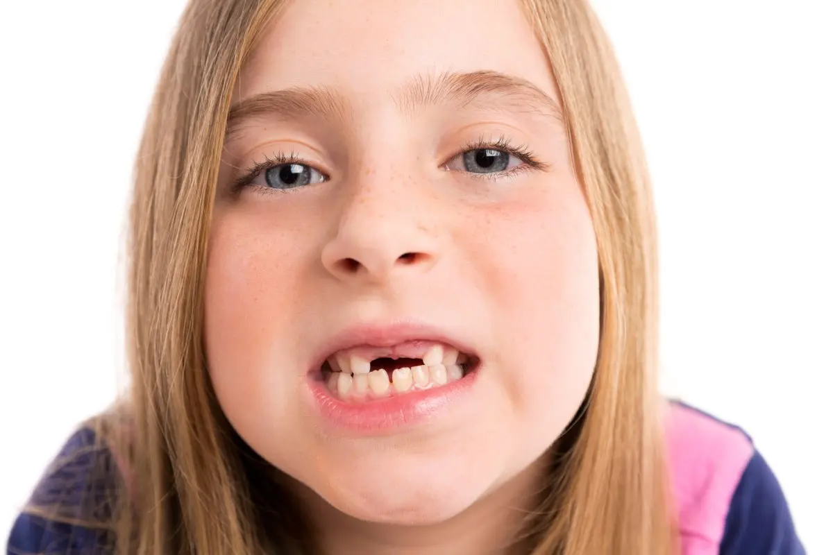 como sacar un diente a un niño - Qué pasa si un niño no se saca un diente