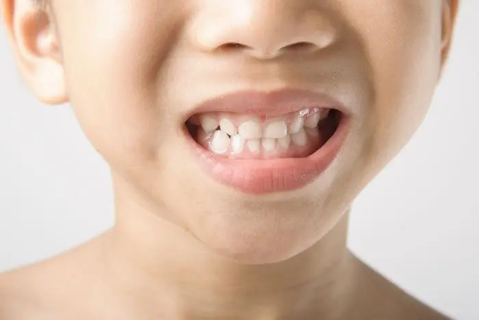 porque los niños rechinan los dientes - Qué pasa si un niño rechina los dientes dormido