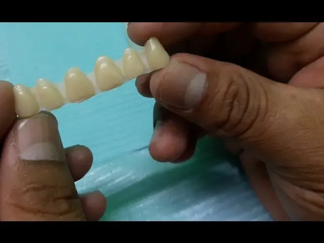 como hacer un diente postizo casero - Qué puedo usar para pegar un diente postizo