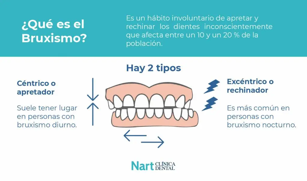 apretar los dientes al dormir - Qué significa apretar los dientes dormido