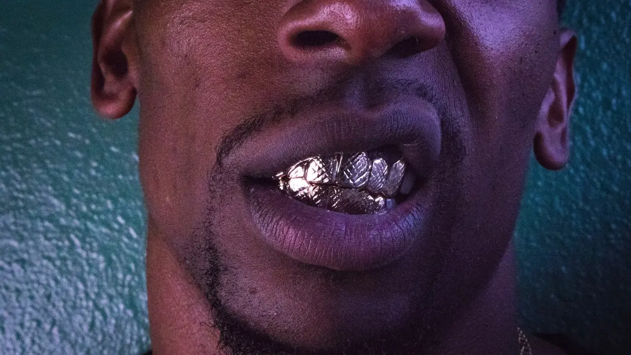 diente de oro - Quién tiene dientes de oro
